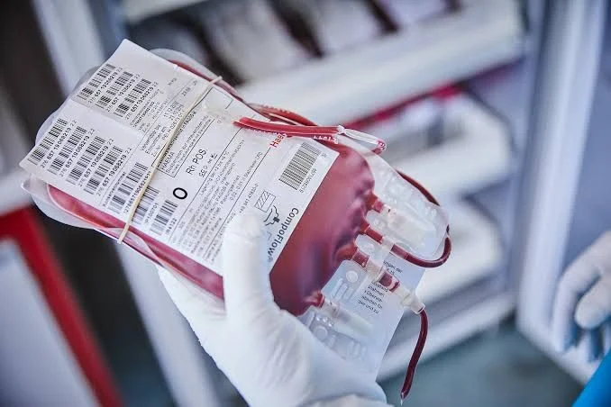 Bolsa de sangue sendo manuseada, com etiquetas visíveis, para armazenamento seguro em banco de sangue.